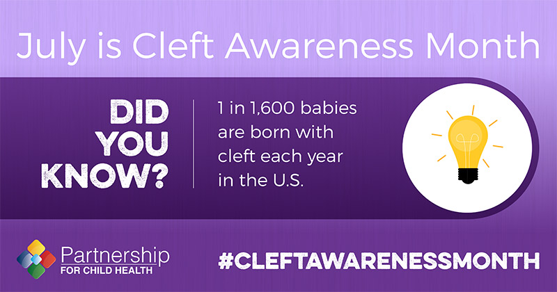 July is Cleft Awareness Month